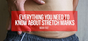 Are Stretch Marks Reversible