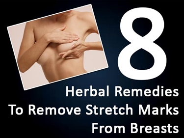Does Tea Tree Oil Get Rid Of Stretch Marks