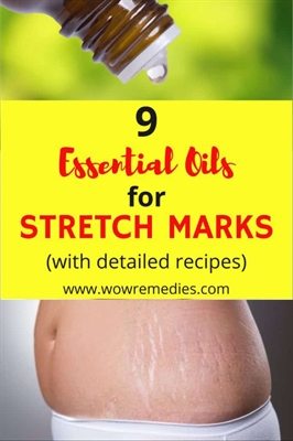 When Do You Start Getting Stretch Marks