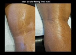 Avon Stretch Mark Cream