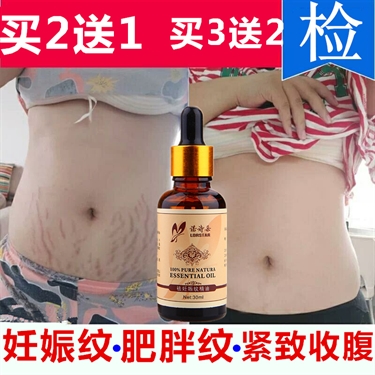 Stretch Mark Surgery Cost