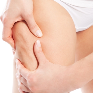 Coconut Oil For Scars And Stretch Marks