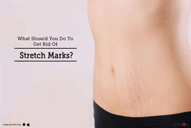Stretch Mark Removal Cream Target