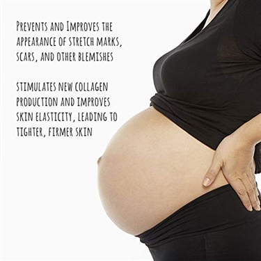 Castor Oil For Stretch Marks Before And After