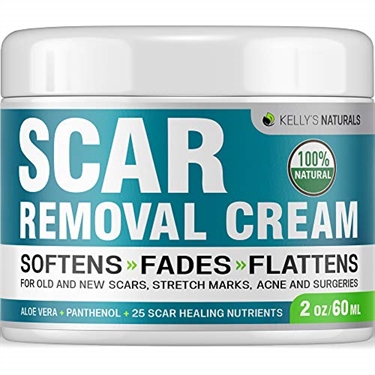 Best Stretch Mark Cream For Men