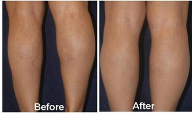 Stretch Mark Cream From It Works