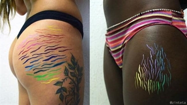 Getting Rid Of Stretch Marks On Breasts