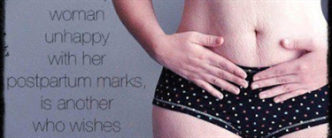 Stretch Mark Exercises