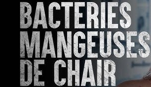 La pire place aux États-Unis : Si vous avez une plaie ouverte aux pieds prenez garde à la bactérie mangeuse de chair en Floride