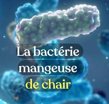 La Floride confirme 5 décès lié au Vibrio (bactérie mangeuse de chair) en raison de l’eau de mer des plages infectées et l’eau stagnante pendant un inondation : voici ce qu’on vous conseil ! La Floride confirme 5 décès lié au Vibrio (bactérie mangeuse de chair) en raison de l’eau de mer des plages infectées et l’eau stagnante pendant un inondation : voici ce qu’on vous conseil !