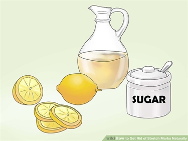 How To Prevent Stretch Marks From Working Out