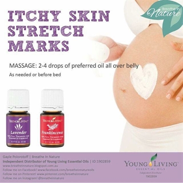 Dark Stretch Marks During Pregnancy