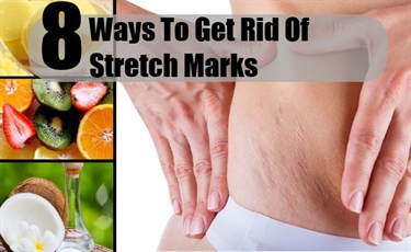 What Does It Mean If You Have Stretch Marks On Your Breasts But You Have Small Breasts