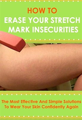 What Are Stretch Marks On Breasts Caused By