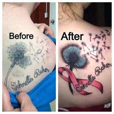 How Can U Get Rid Of Stretch Marks