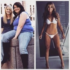 Stretch Marks Or Cellulite