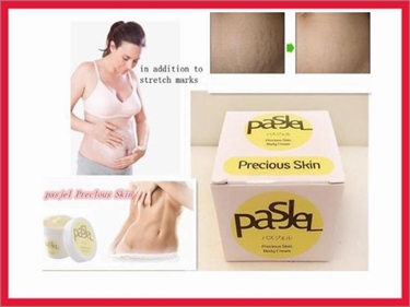 Decrease Stretch Marks