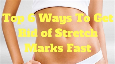 Stretch Marks Home Remedy
