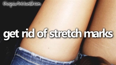 Treatment For Old Stretch Marks