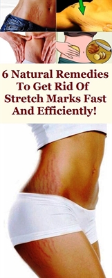 How To Get Rid Of Dark Stretch Marks After Pregnancy