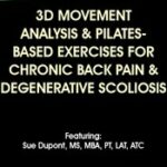 3D Movement Analysis & Pilates-Based Exercises for Chronic Back Pain & Degenerative Scoliosis – Sue DuPont