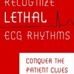 Recognize Lethal ECG Rhythms