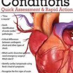 Acute Cardiac Conditions