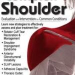 The Complex Shoulder