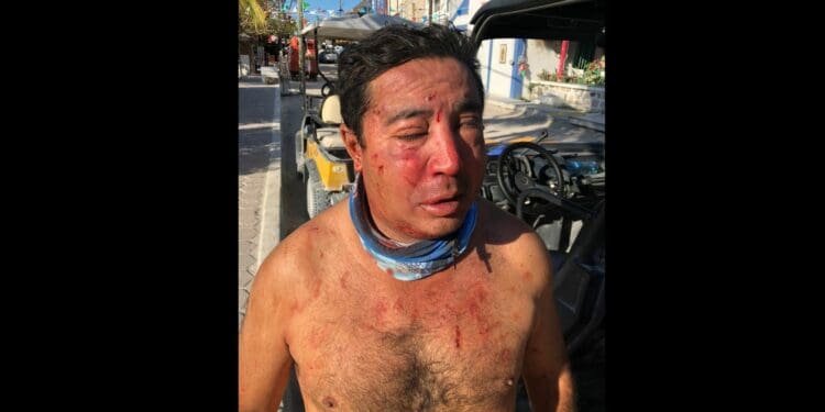 Agreden a taxista de Holbox; ya detuvieron a responsables