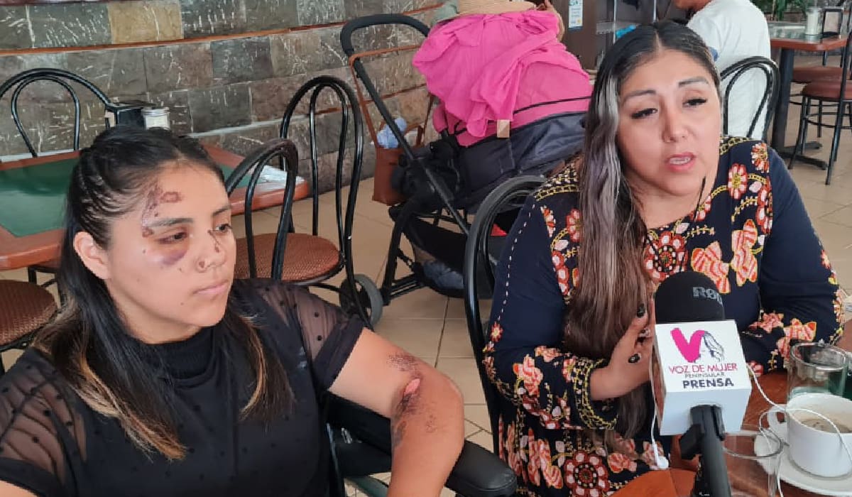 Piden ayuda para localizar a conductor que atropelló a una joven y se dio a la fuga en el centro de Playa del Carmen