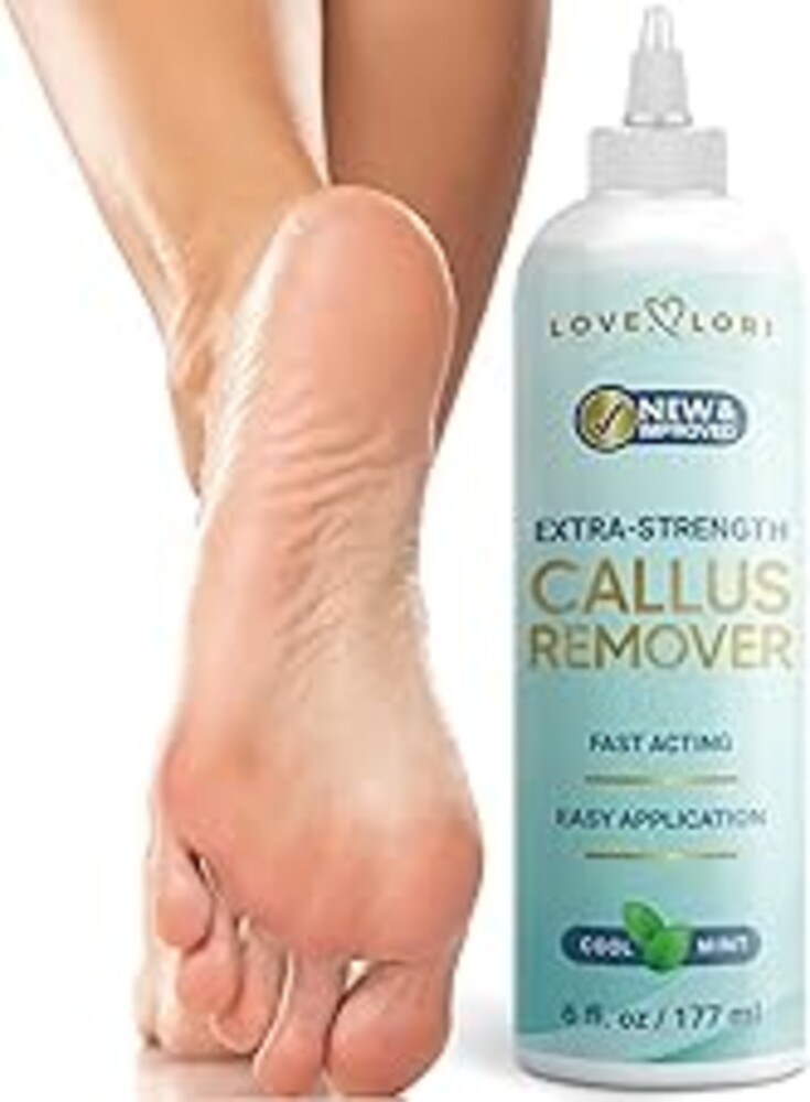 Love Lori Foot Callus Remover Gel Extra Strength Pedicure Tool for Feet 6oz | Quickly, easily, softens and removes dead, hard skin on heels & feet; salon-quality pedicure results at home