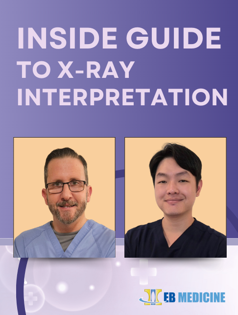 Inside Guide to X-Ray Interpretation