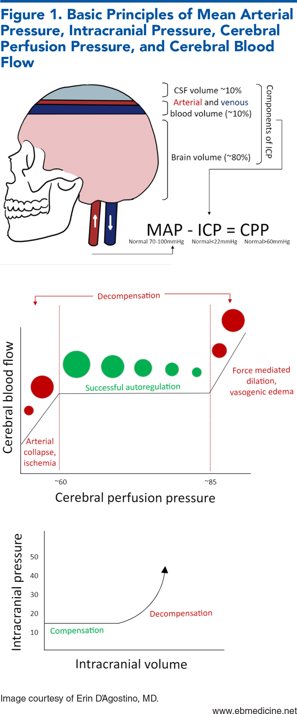 Figure 1. Basic Principles of Mean Arterial Pressure, Intracranial Pressure, Cerebral Perfusion Pressure, and Cerebral Blood Flow