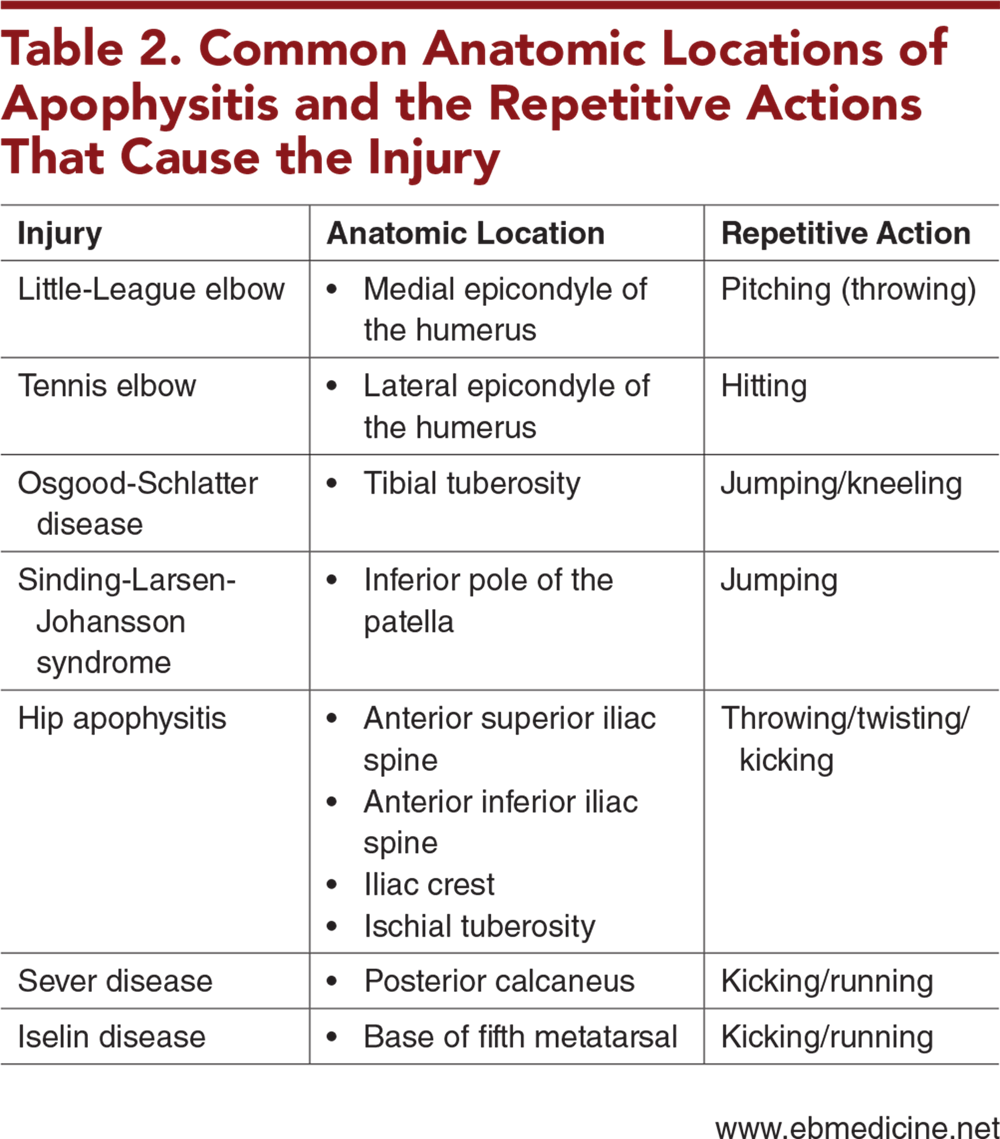 Table 2. Common Anatomic Locations of Apophysitis and the Repetitive Actions That Cause the Injury