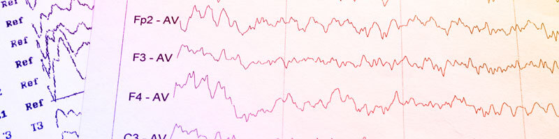 Status Epilepticus Banner