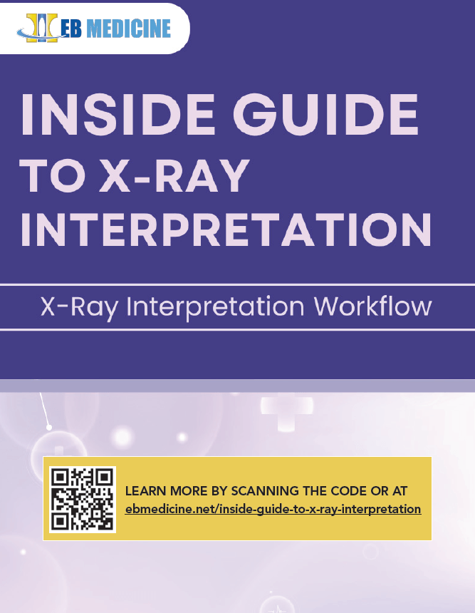 Inside Guide to X-Ray Interpretation