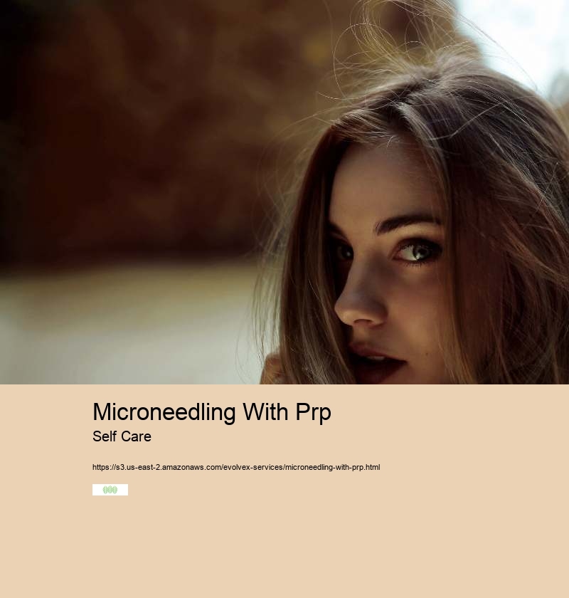 Rf Microneedling