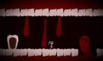 Teaser