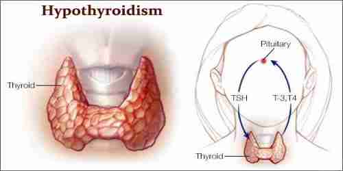 Is Omega 3 Good For Hypothyroidism