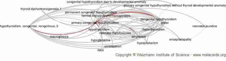 Does Hypothyroidism Cause Pvcs