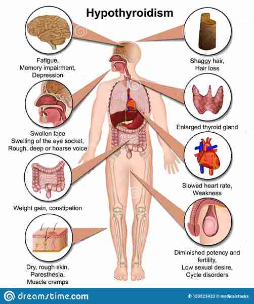 Hypothyroidism And Ct Contrast