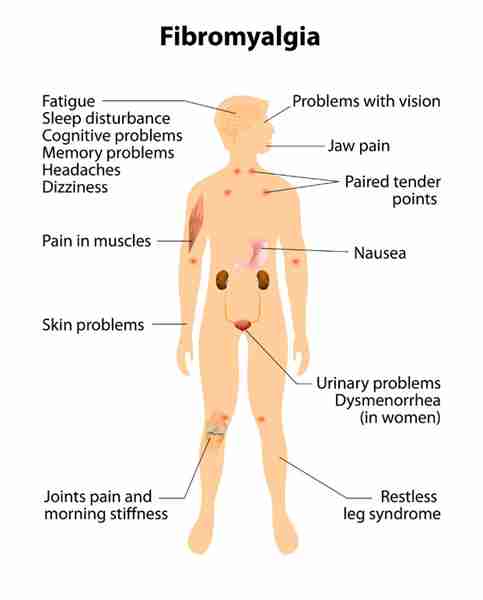 Hypothyroidism Glucose