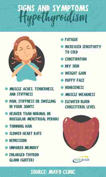 Hypothyroidism Swollen Neck