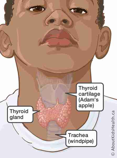 Can Hypothyroidism Cause Gynecomastia