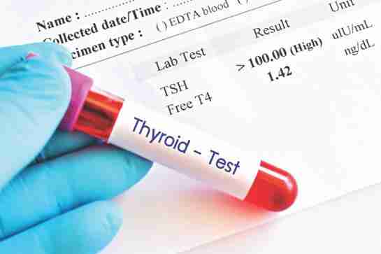Hypothyroidism And Wfpb Diet