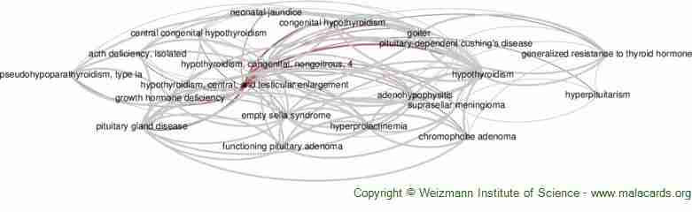 Hypothyroidism Ears Ringing