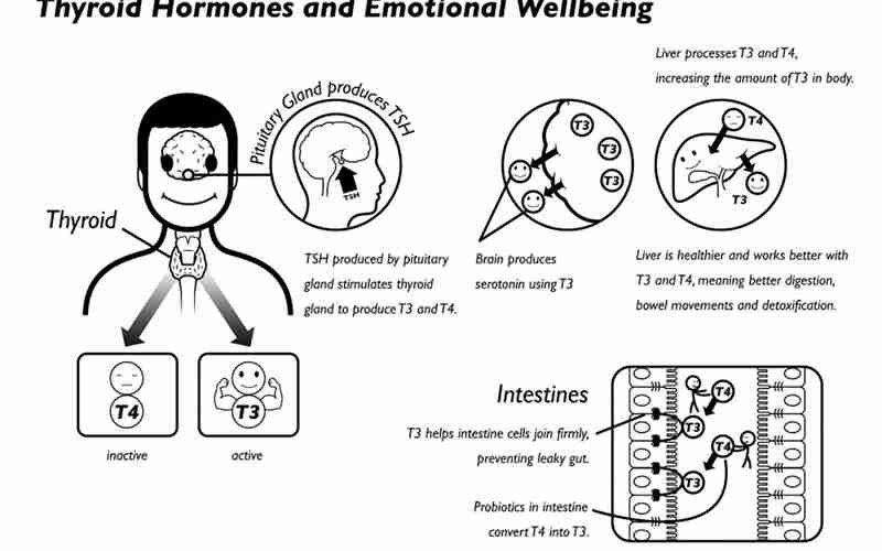 Hypothyroidism And Ibs-D