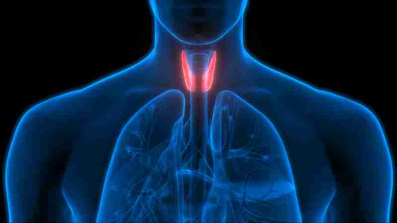 Hypothyroidism Nodule