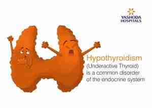 Hypothyroidism Australia