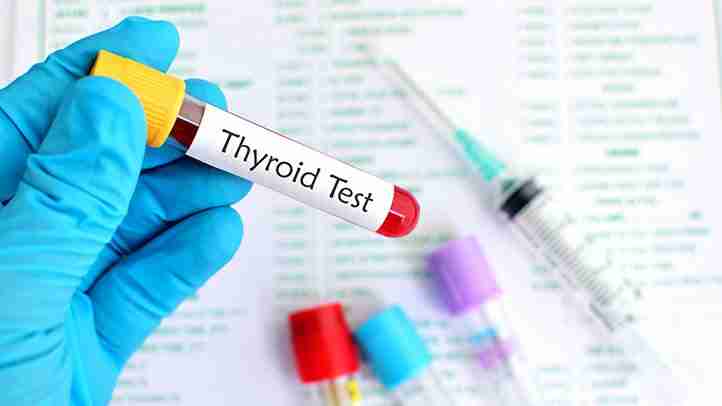 Hypothyroidism Total Thyroidectomy